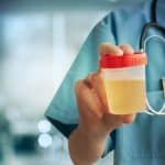 Medical Urine Test, Close-Up