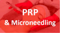 PRP Microneedling