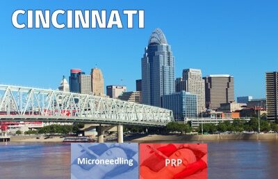 Cincinnati Regenerative Aesthetics Training PRP Microneedling
